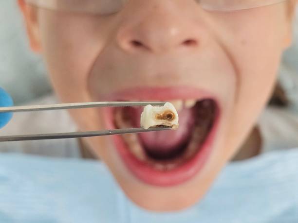 Best Pediatric Emergency Dentist in Corona De Tucson, AZ